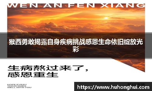 猴西勇敢揭露自身疾病挑战感恩生命依旧绽放光彩